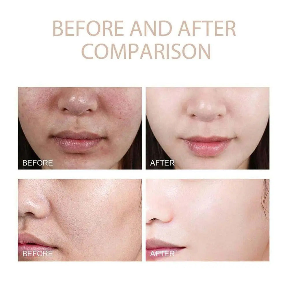 Korean Dr. Melaxin Rice Exfoliating Essence Moisturizing Peel Shot White And Black Soften Serum Gentle Exfoliation Skin Care