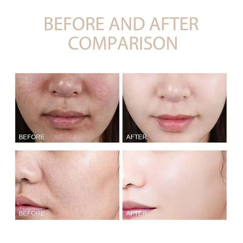 Korean Dr. Melaxin Rice Exfoliating Essence Moisturizing Peel Shot White And Black Soften Serum Gentle Exfoliation Skin Care