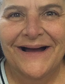 Before - Amazing Results!