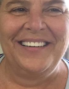 After - Amazing Results!