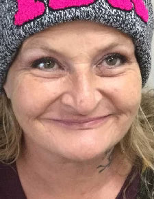 Before - Works Wonders!