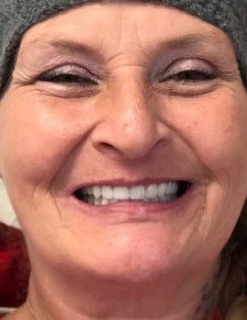 After - Works Wonders!