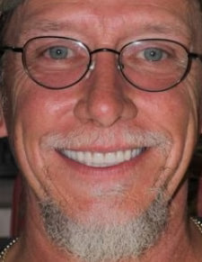 After - Highly Recommend!